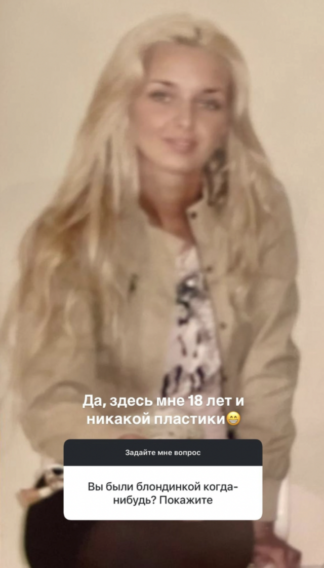 Жена Тимура Хайдарова Светлана Сильваши показала, как выглядела до пластики1